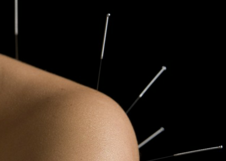 Facial Enhancement Acupuncture